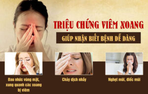 Viêm xoang quai hàm là bệnh gì